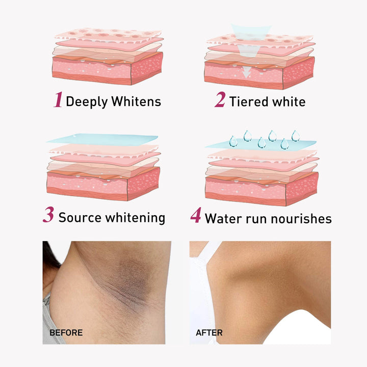 EELHOE Whitening Cream – Underarm, Legs, Knees, Elbows, Inner Thighs & Joints