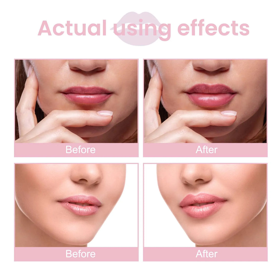 EELHOE Lip Enriching Essence – Plumps, Hydrates & Smooths – With Vitamin E, Jojoba Oil & Hyaluronic Acid – 4ml