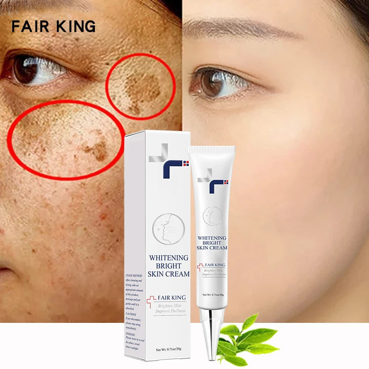 FAIR KING Dark Spot Corrector & Whitening Cream