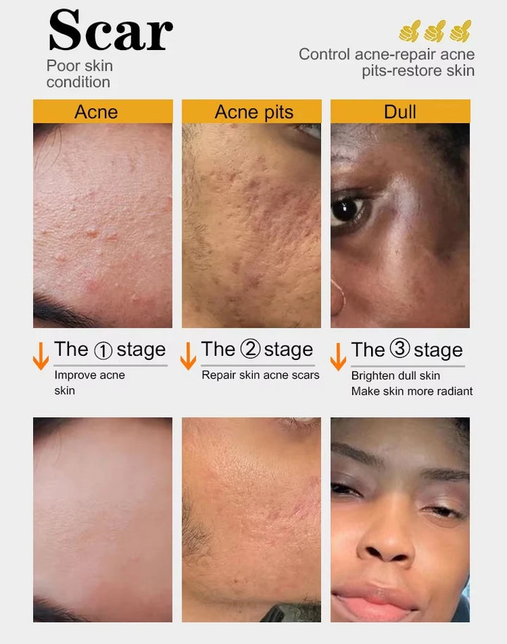 Radiance Revival Turmeric Skincare Set – Brighten, Hydrate & Even Tone