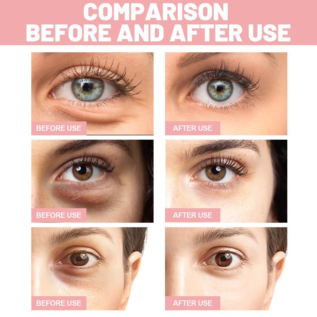 Eye Mask Fades Fine Lines, Eye Bags, Eye Mask