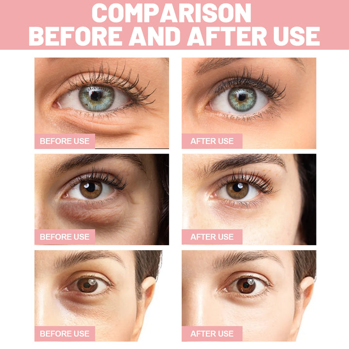 Eye Mask Fades Fine Lines, Eye Bags, Eye Mask