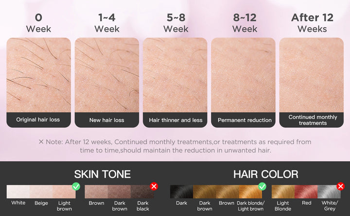 INNZA IceCool IPL Hair Removal Device – 9 Levels for Painless, Permanent Results
