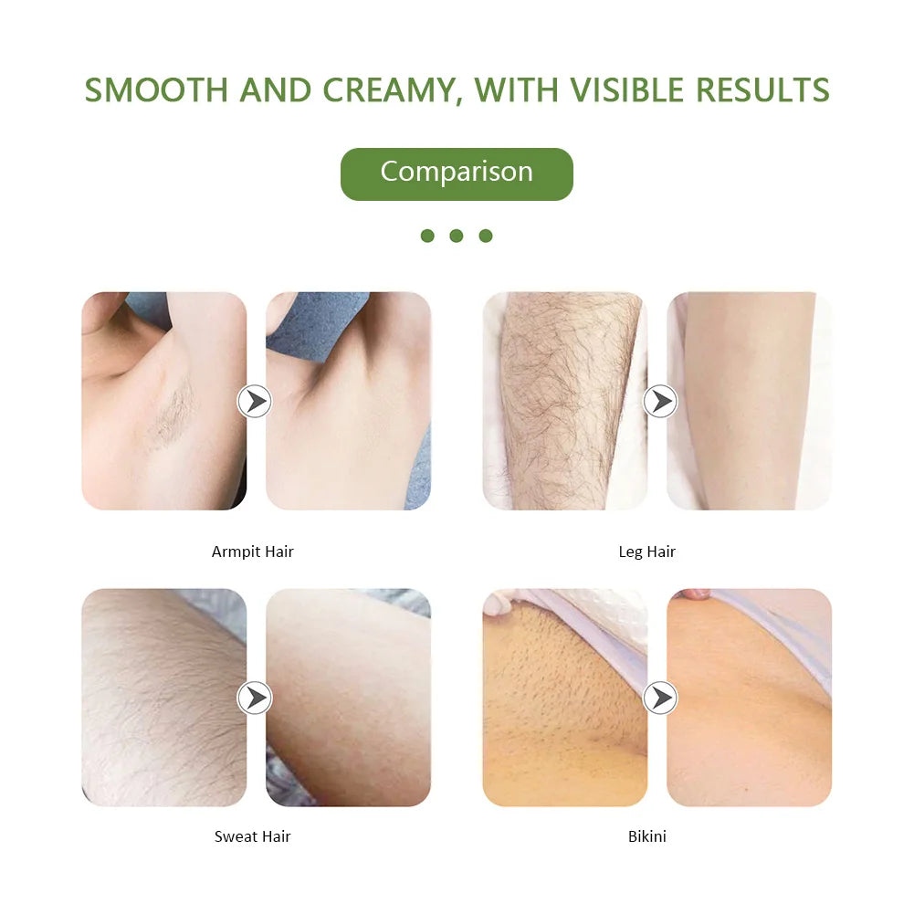 EmpowerEase SmoothGlide Portable Electric Epilator