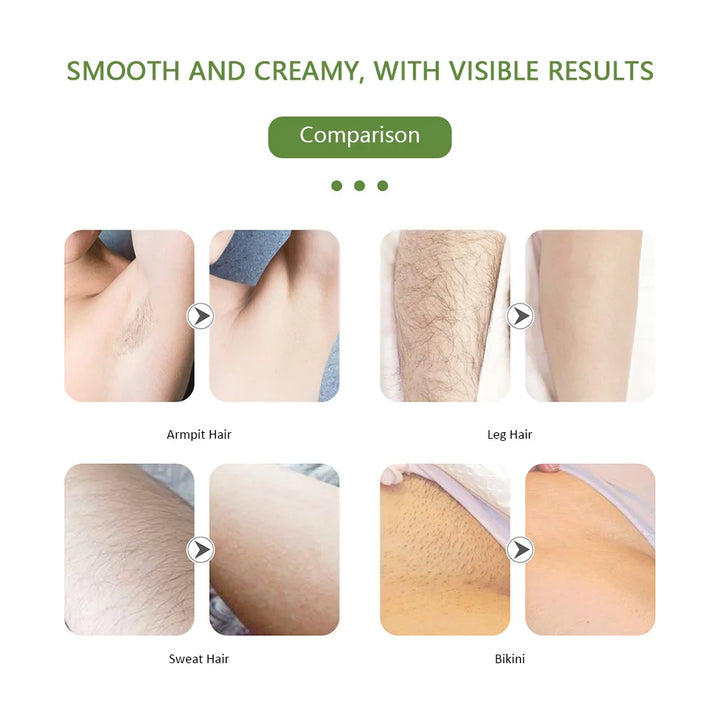 EmpowerEase SmoothGlide Portable Electric Epilator