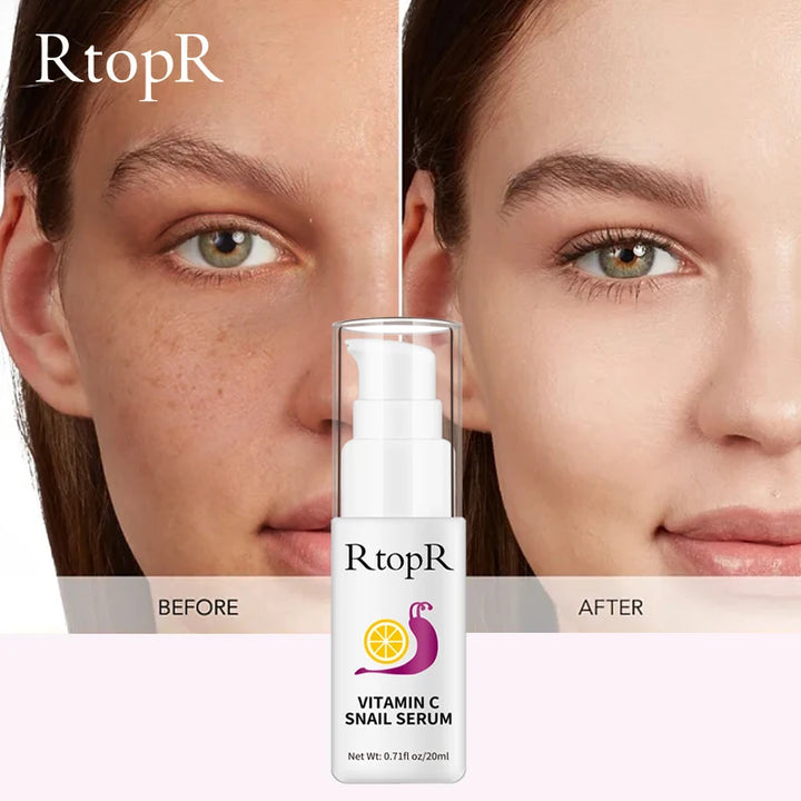 Radiant Renewal Serum – Vitamin C & Snail Essence Firming Elixir