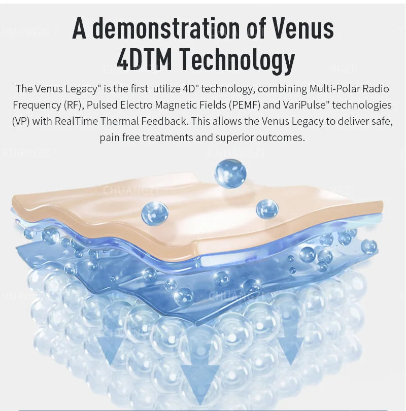 EmpowerEase Venus Legacy Cavitation & RF Body Contouring System