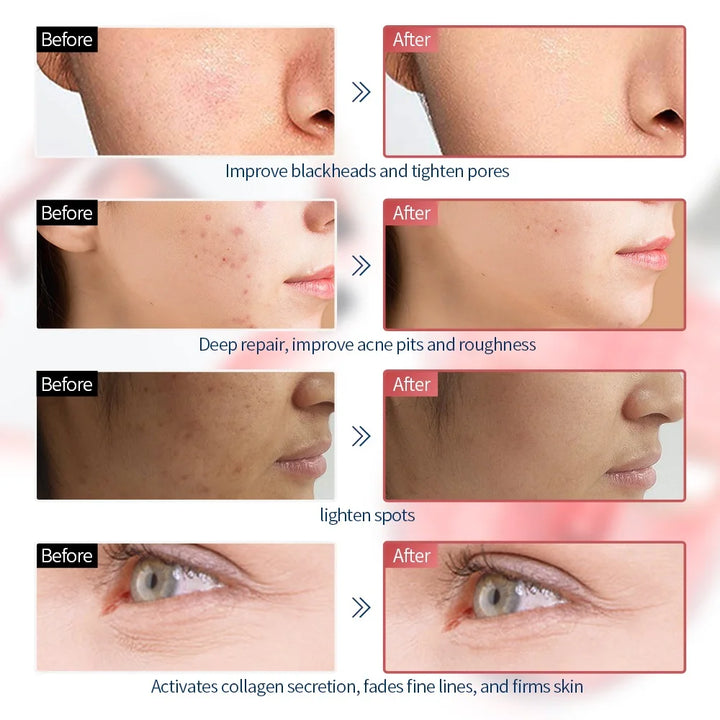 RadianceRenew 7-Color LED Face Mask – Wireless Skin Rejuvenation & Anti-Aging Therapy