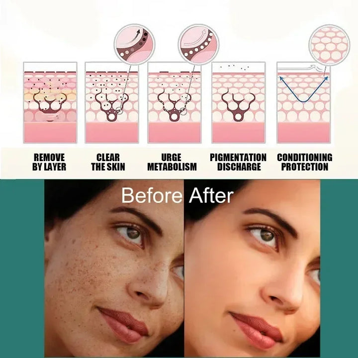 EELHOE Niacinamide Brightening Cream – Fade Melasma, Dark Spots & Fine Lines