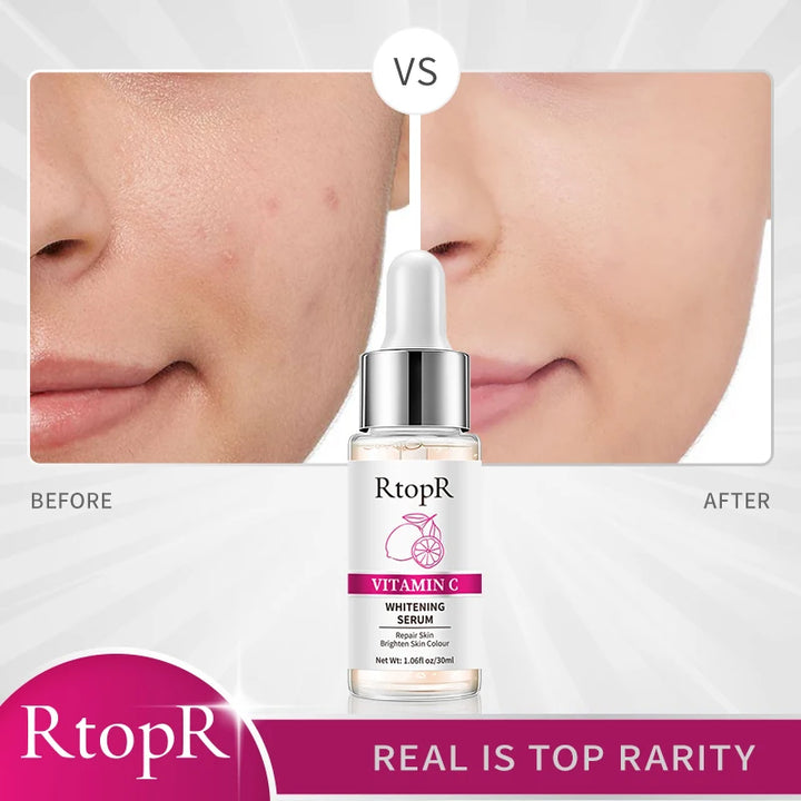 RtopR Vitamin C Whitening Serum (30ml)