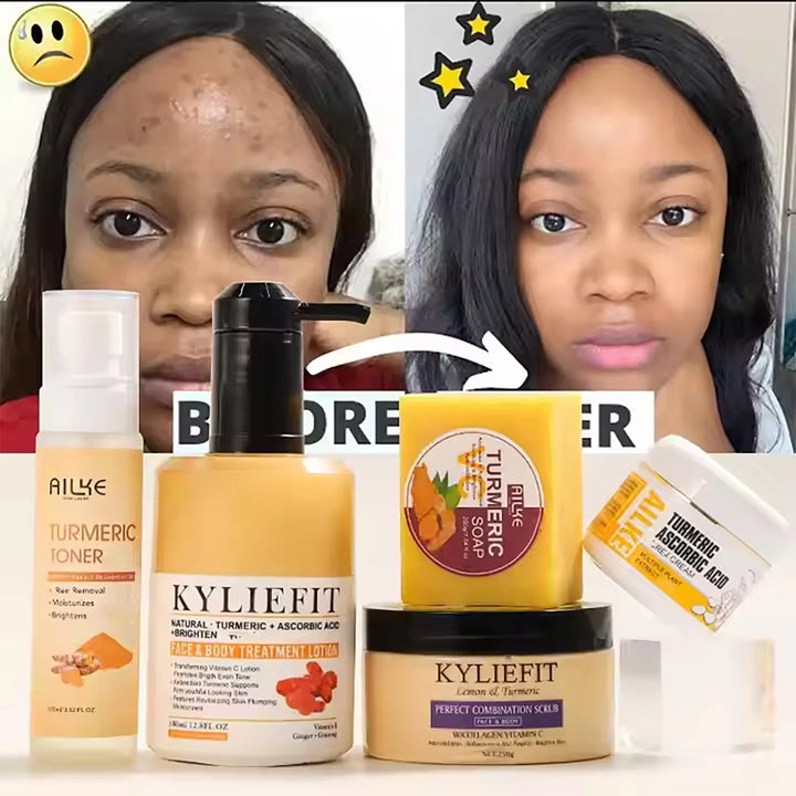 Radiance Ritual Turmeric Skincare Set – Brighten, Clear & Glow Naturally