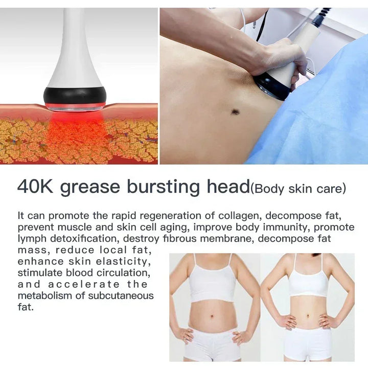 40K Ultrasonic Cavitation & RF EMS Machine – Body Slimming, Facial Lifting & Skin Tightening Beauty Device