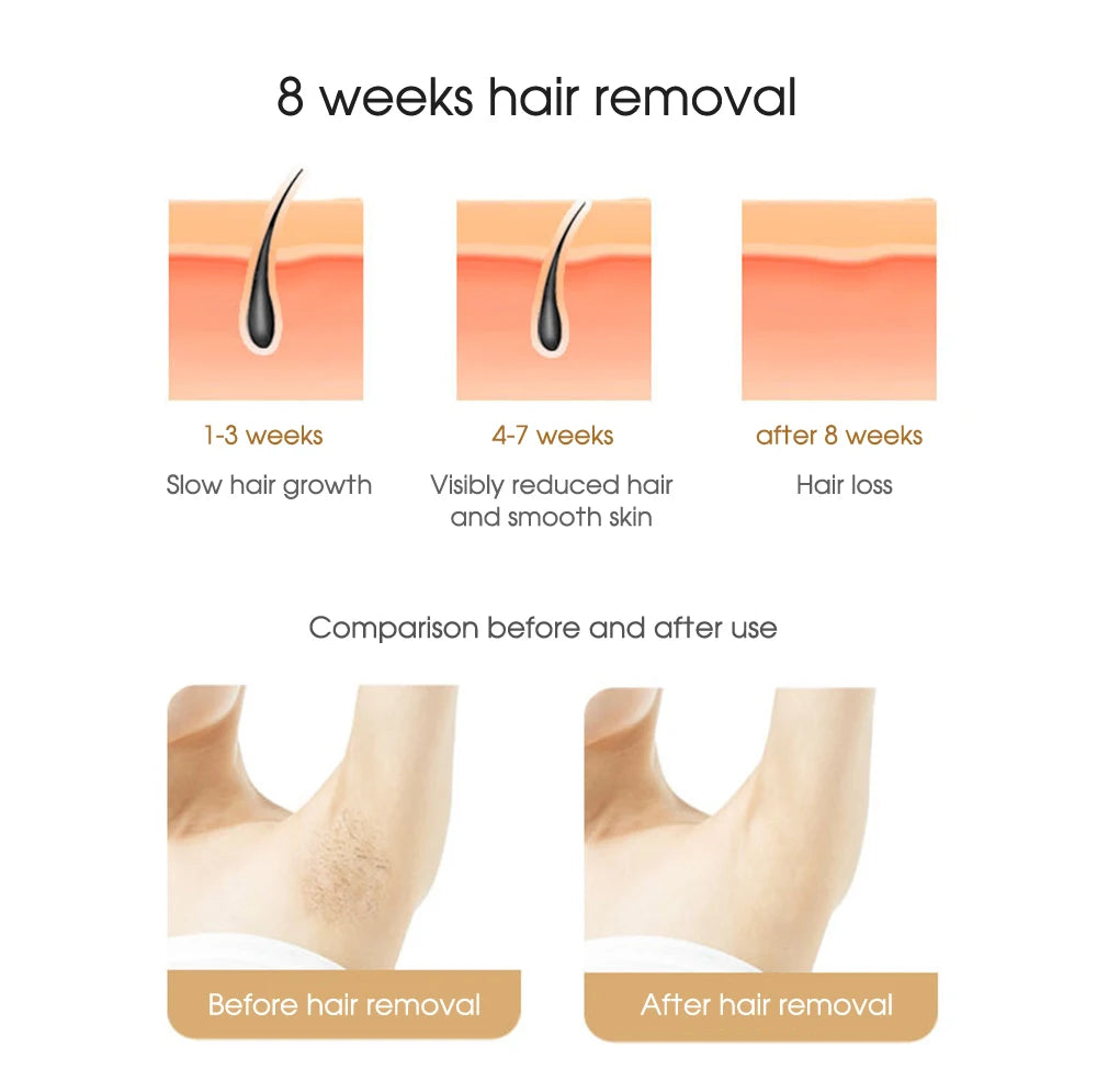 LumiSmooth IPL Laser Hair Removal Device