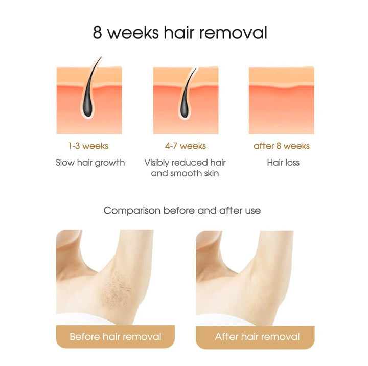 LumiSmooth IPL Laser Hair Removal Device