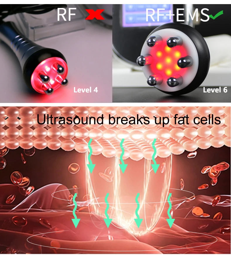 40K Ultrasonic Cavitation & RF EMS Machine – Body Slimming, Facial Lifting & Skin Tightening Beauty Device