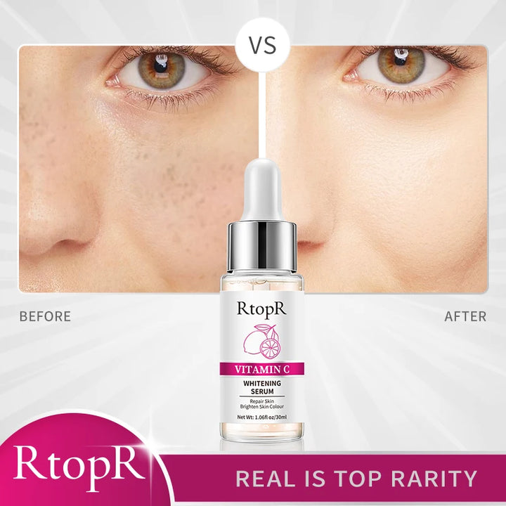 RtopR Vitamin C Whitening Serum (30ml)