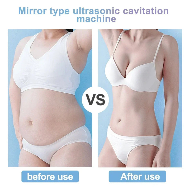 40K Ultrasonic Cavitation & RF EMS Machine – Body Slimming, Facial Lifting & Skin Tightening Beauty Device