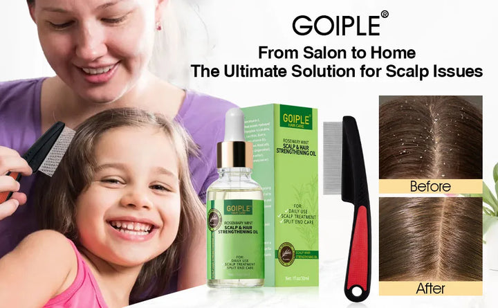 Goiple Rosemary Mint Hair Growth Serum – Essential Oil Treatment for Dry, Damaged & Thinning Hair
