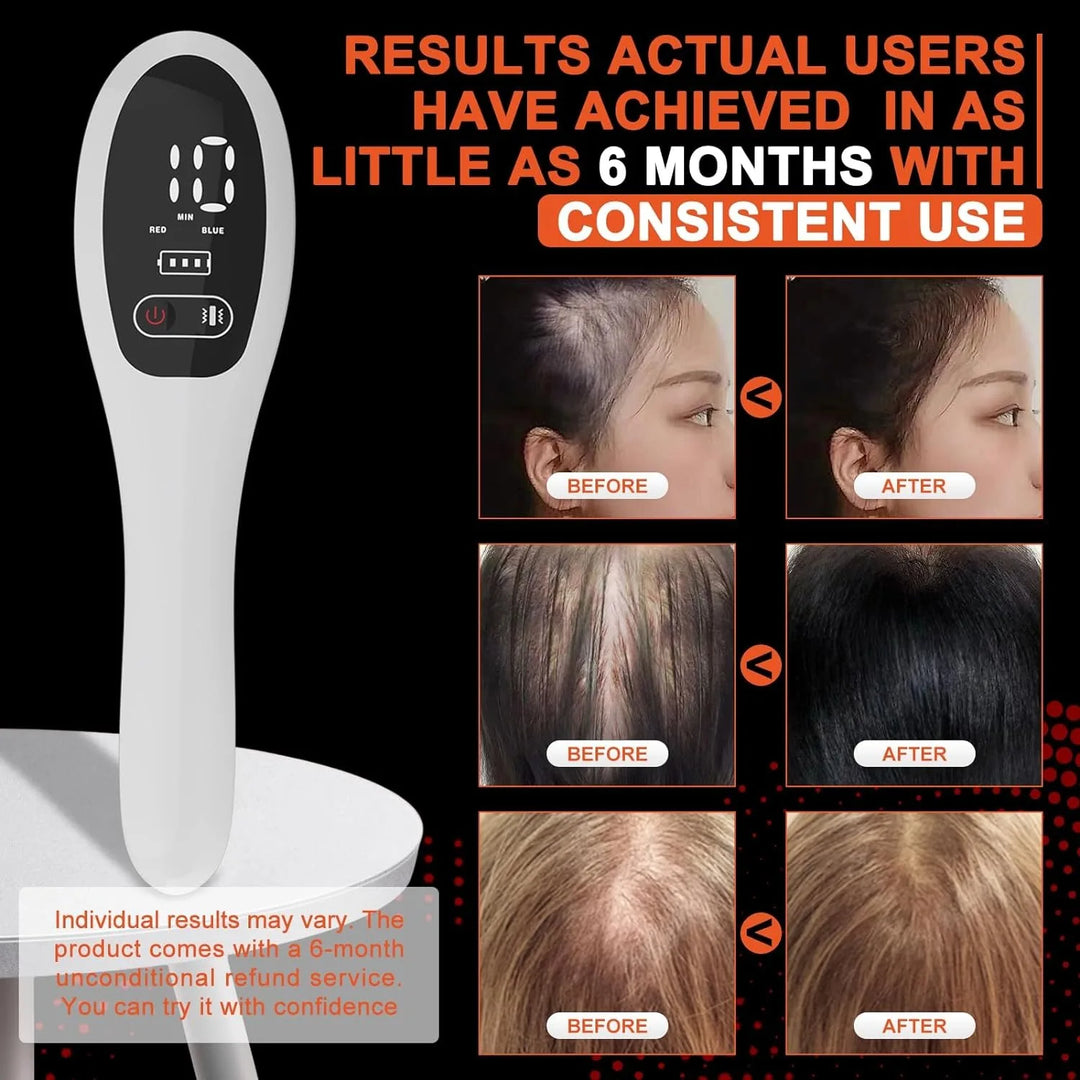 EmpowerRoots Red Light Therapy Comb