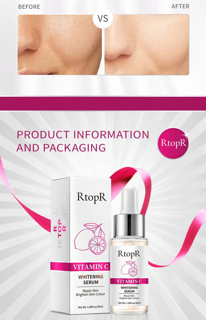 RtopR Vitamin C Whitening Serum (30ml)