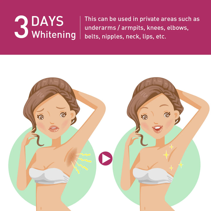 EELHOE Whitening Cream – Underarm, Legs, Knees, Elbows, Inner Thighs & Joints