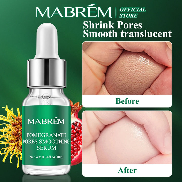 MABREM Pomegranate Pore-Refining Serum – Plant-Based Essence for Smooth, Bright, and Hydrated Skin (10ml)