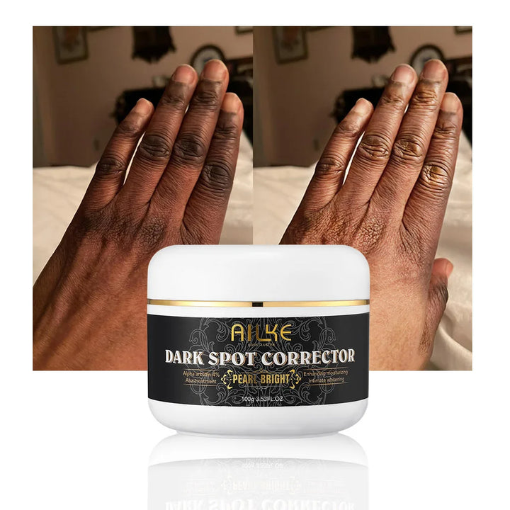 Radiance Renewal Dark Spot Corrector – Face & Body Brightening Cream