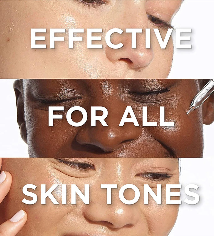 Radiance Renewal Dark Spot Corrector – Face & Body Brightening Cream
